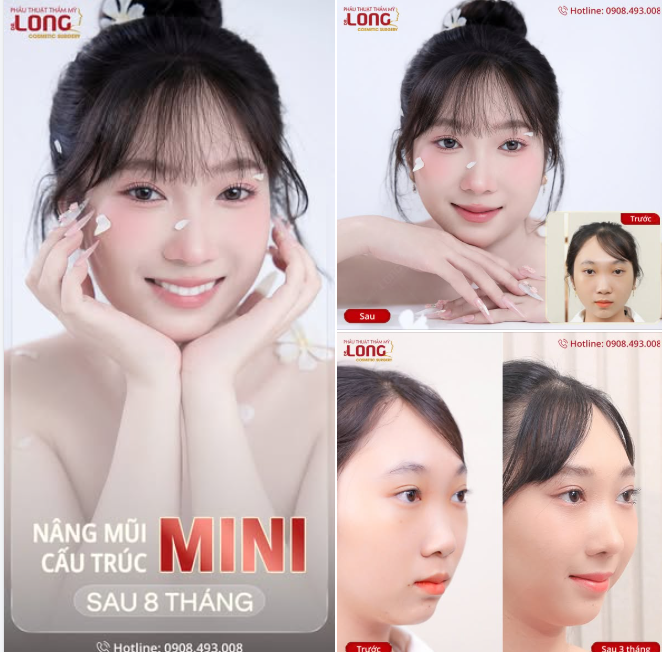 MŨI ĐẸP RỒI VIỆC CỦA EM LÀ XINH