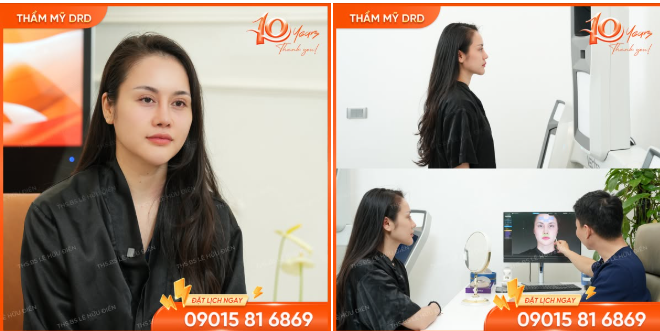 Mí cắt to - hốc mắt trũng sâu vì lấy mỡ quá tay.