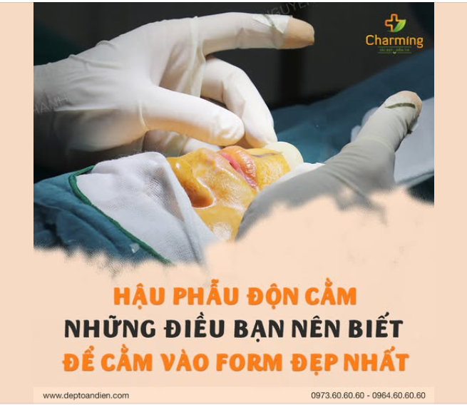 HẬU PHẪU ĐỘN CẰM – NHỮNG ĐIỀU BẠN NÊN BIẾT ĐỂ CẰM VÀO FORM ĐẸP NHẤT