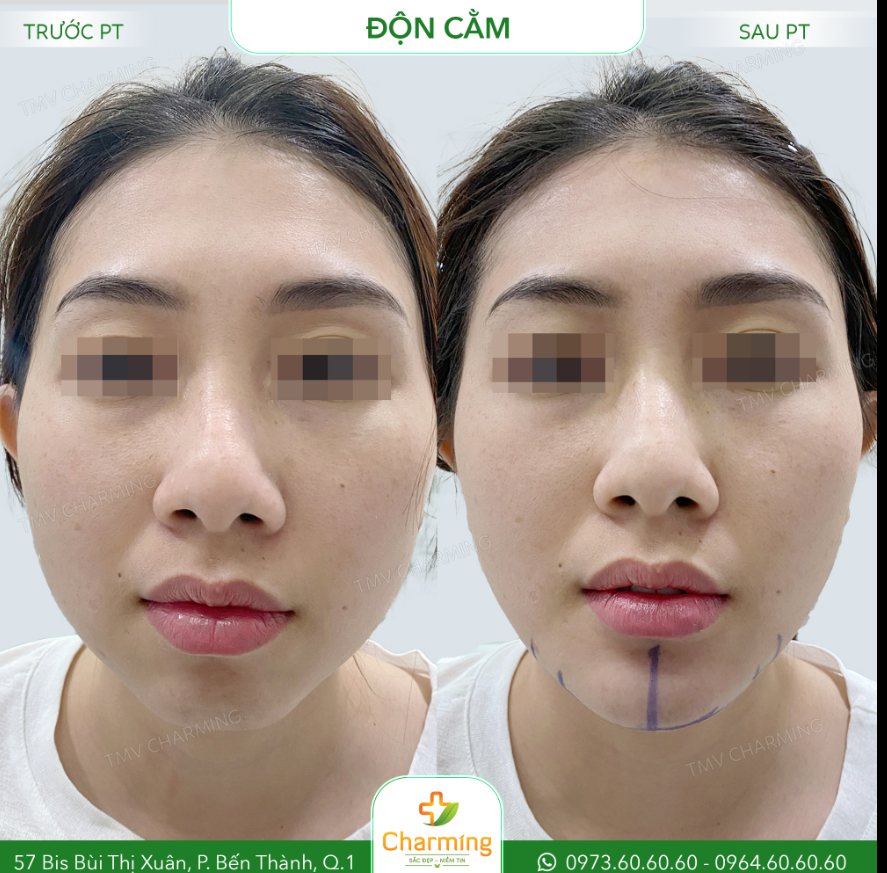 Nàng khách cũng chia sẻ là giờ đây tự tin hơn rất nhiều, nhất là khi chụp hình selfie!