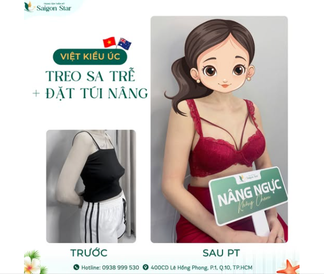 COMBO TREO SA TRỄ + NÂNG VÒNG 1 KHÔNG CHẠM  14 NGÀY TỰ TIN NHƯ THỜI SON SẮC