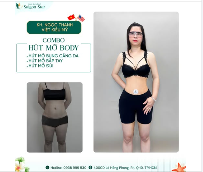 Chị khách Việt kiều mỹ lột x.á.c ngoạn mục – Yêu bản thân hơn mỗi ngày!