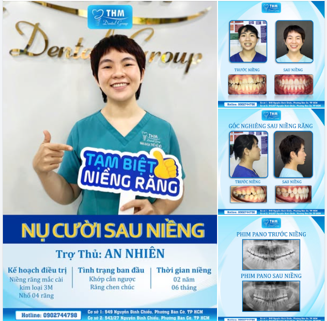 CHÚC MỪNG AN NHIÊN CHÍNH THỨC “TẠM BIỆT NIỀNG RĂNG”!