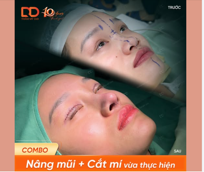 "Mở bát" đầu tuần với combo "mở khoá" nhan sắc cho bạn gái 2k5.