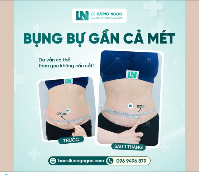 BỤNG BỰ GẦN CẢ MÉT