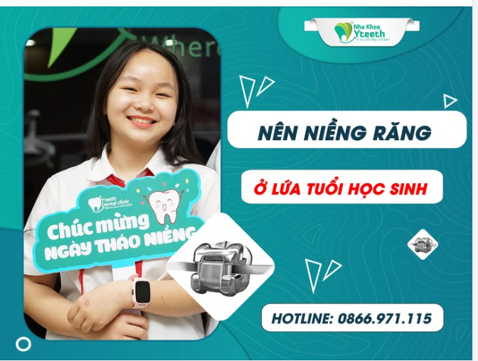 Việc niềng răng ở lứa tuổi học sinh là hoàn toàn nên và có nhiều lợi ích.