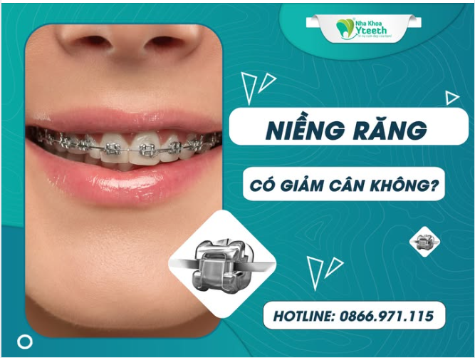 Niềng răng có giảm cân không?
