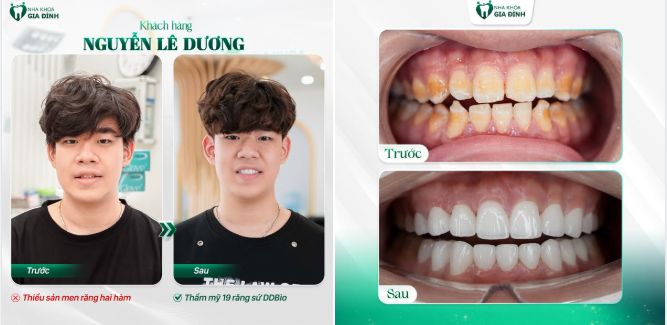 Đánh dấu tuổi mới bằng một nụ cười chuẩn tự tin!