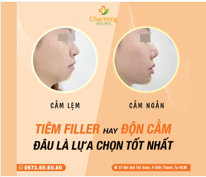 PHÂN BIỆT ĐỘN CẰM VÀ TIÊM FILLER – NÊN CHỌN PHƯƠNG PHÁP NÀO?