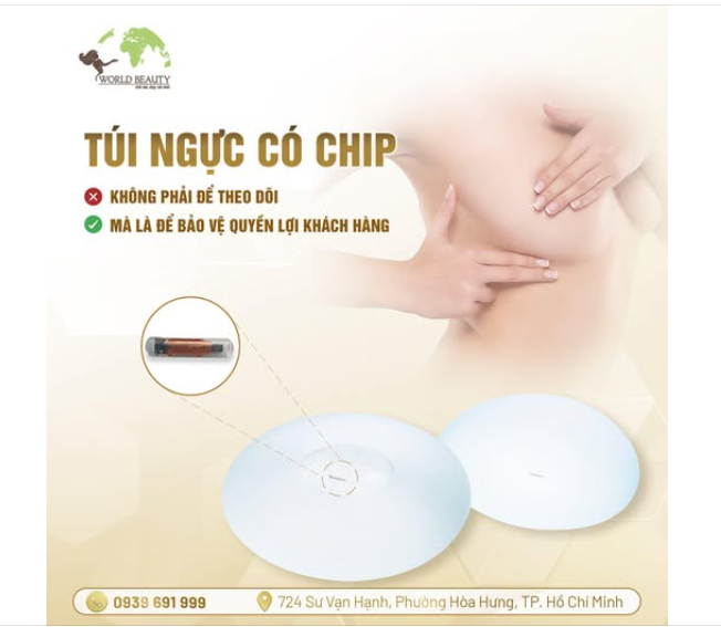 Túi ngực có chip – Không phải để theo dõi, mà là để bảo vệ quyền lợi của Khách hàng.