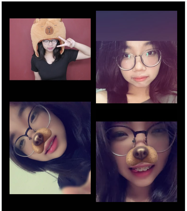 Hành trình niềng răng không chỉ là thay đổi nụ cười, mà còn là cách bạn yêu bản thân mỗi ngày!
