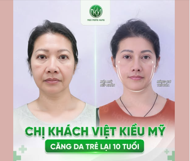 Sau 50 tuổi, làn da bắt đầu xuất hiện dấu hiệu thời gian: từ độ săn chắc đến đường nét khuôn mặt dần thay đổi