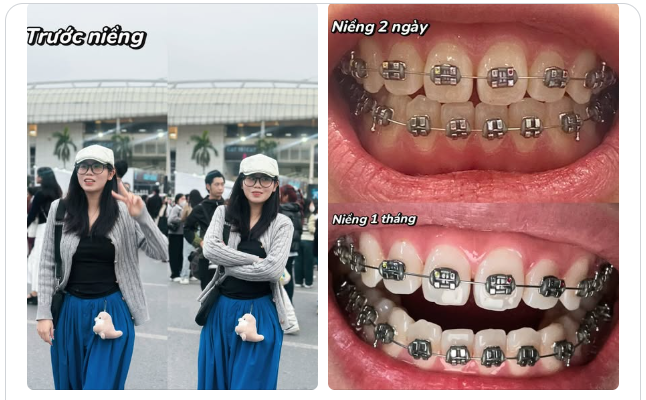 "Hãy hành động để 5 năm tới, bạn có thể mỉm cười thật rạng rỡ và nói: “May mà mình đã làm điều đó.”