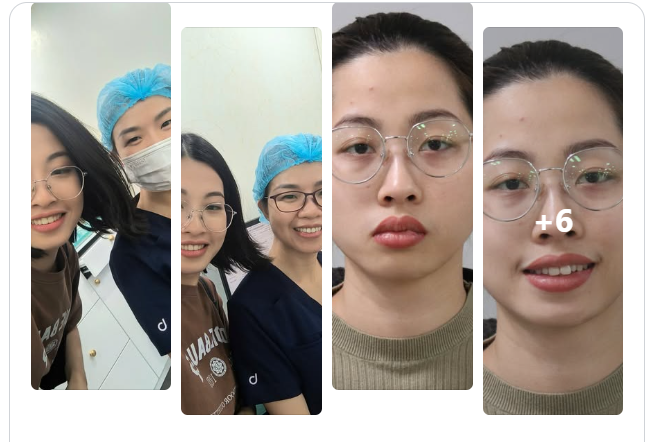 Từ "cười mím môi" sang "cười tỏa nắng", một hành trình không hề nhỏ bé!