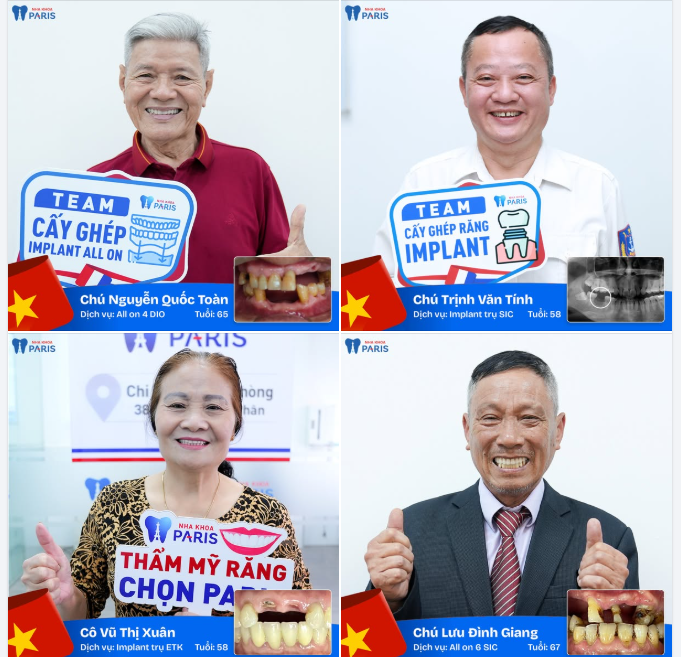 Ăn ngon, sống khoẻ, trọn niềm vui sau TRỒNG RĂNG IMPLANT