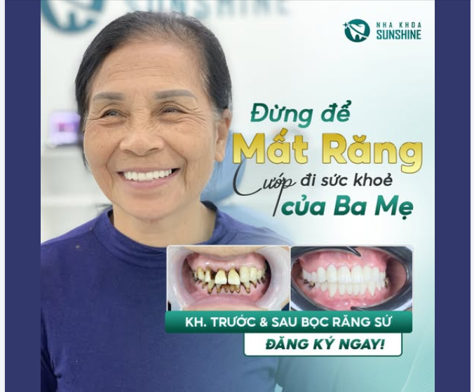 ĐỪNG ĐỂ MẤT RĂNG CƯỚP ĐI SỨC KHOẺ CỦA BA MẸ!