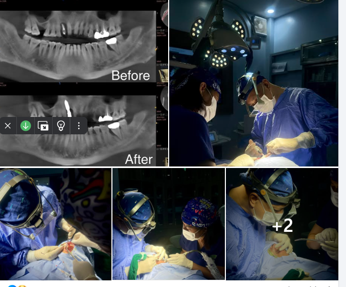 KHÁCH HÀNG HÀI LÒNG SAU CA ĐIỀU TRỊ PHỨC TẠP TẠI NHA KHOA 24H