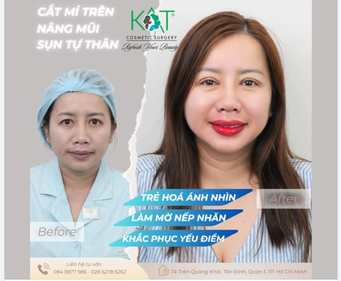 Hiệu quả thấy rõ chỉ sau một thời gian ngắn – nhẹ nhàng nhưng thay đổi rất khác.