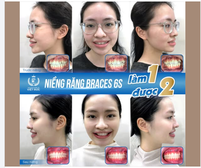 Ngày trước: Cười? Em xin phép… che miệng!