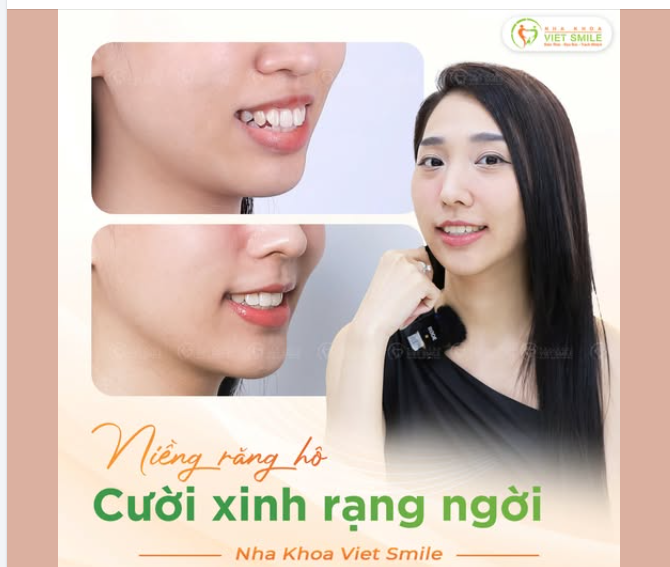 NIỀNG RĂNG "KHÔNG ĐIỂM"