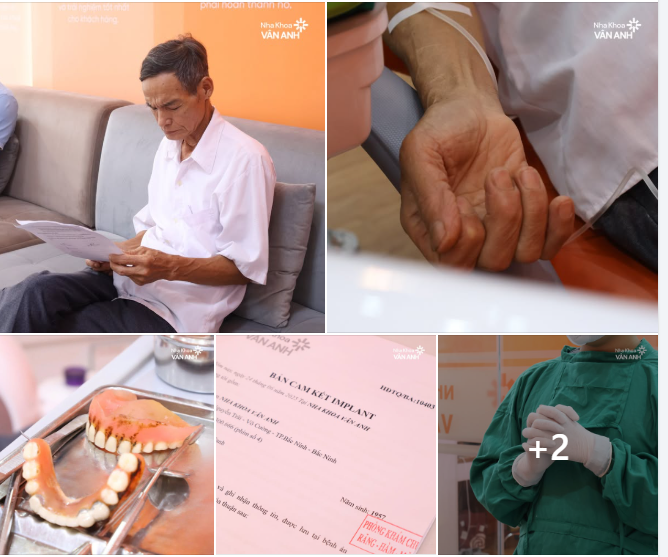 Trồng răng toàn hàm - Không chỉ là phục hình răng,mà là niềm vui, sự tự tin và chất lượng sống!