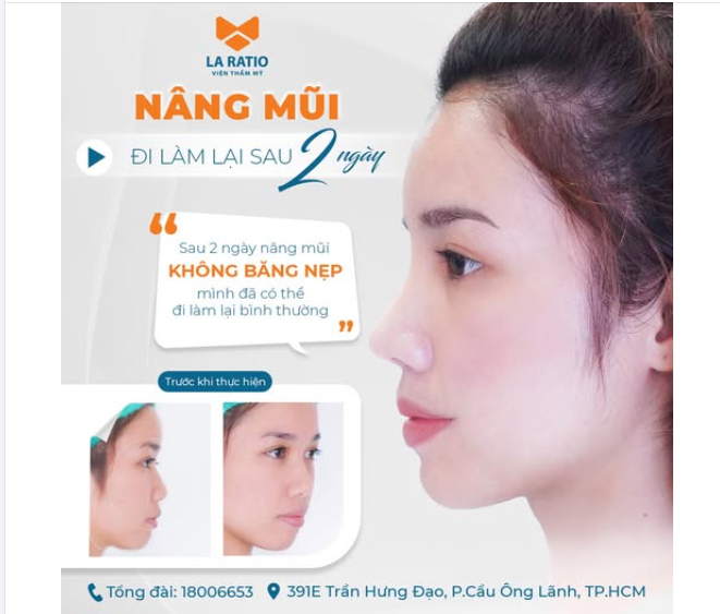 Với quy trình chuyên sâu từ thăm khám đến chăm sóc hậu phẫu 1:1, đây chính là giải pháp nâng mũi hiện đại – phù hợp cho những ai bận rộn nhưng vẫn muốn đẹp mọi góc nhìn.