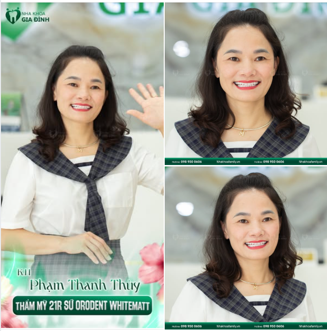 Nụ cười duyên dáng - Tỏa sáng "chất" riêng