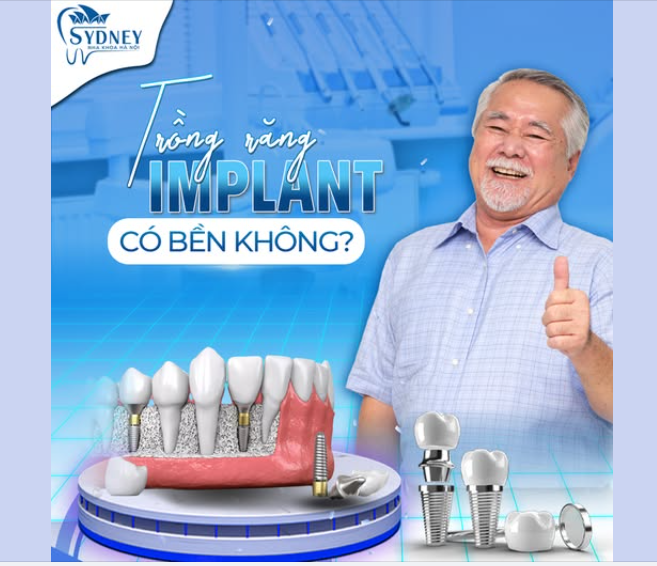 TRỒNG RĂNG IMPLANT CÓ BỀN KHÔNG?