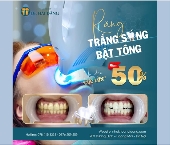 RĂNG TRẮNG SÁNG – TỰ TIN BẬT TÔNG