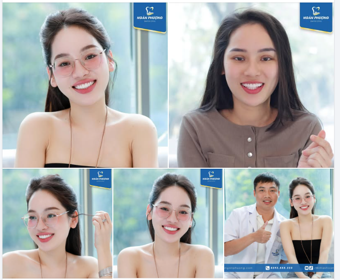 3 năm làm răng sứ, chỉ có đẹp hơn, không có đẹp nhất