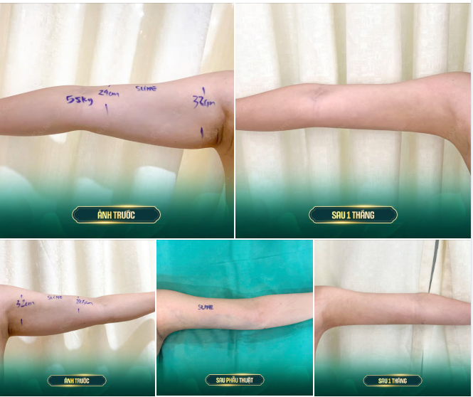 Sau 1 tháng – kết quả khiến chính khách hàng cũng bất ngờ!