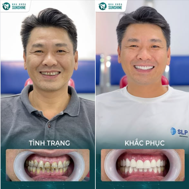 ĐẾM NGƯỢC CHÀO MỪNG 2/9 - TÂN TRANG NỤ CƯỜI RẠNG RỠ!