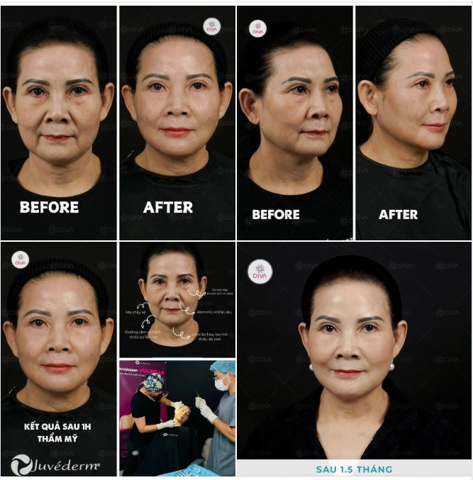 MD CODES - CẢI THIỆN SỰ CHẢY X.Ệ VÀ LÃO HÓA HIỆU QUẢ, NHANH CHÓNG