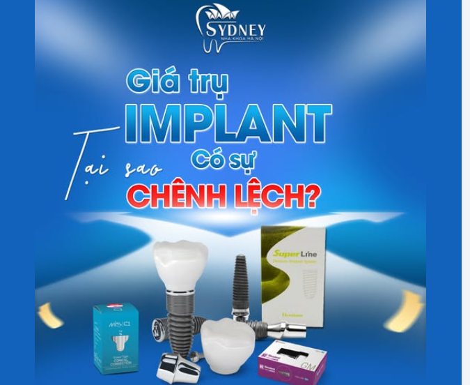 GIÁ TRỤ IMPLANT TẠI SAO CÓ SỰ CHÊNH LỆCH?