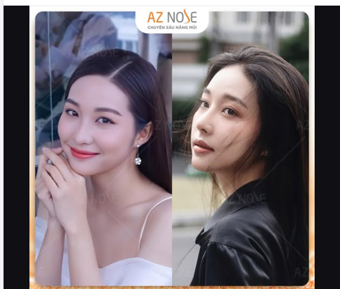 Thần thái cuốn hút, có chiều sâu của Top35 HHVN 2020 - Phương Thảo sau  2năm nâng mũi