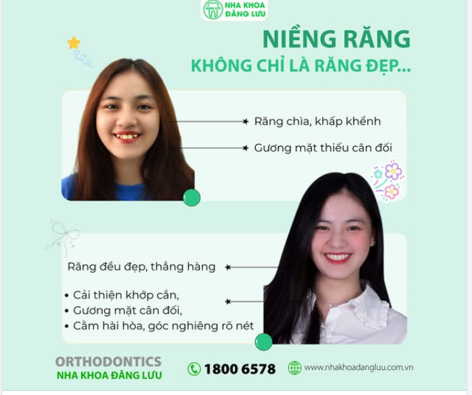 KHÔNG CHỈ LÀ RĂNG ĐẸP: VÌ SAO CHỈNH NHA CÒN "LÀM MỚI" CẢ KHUÔN MẶT?