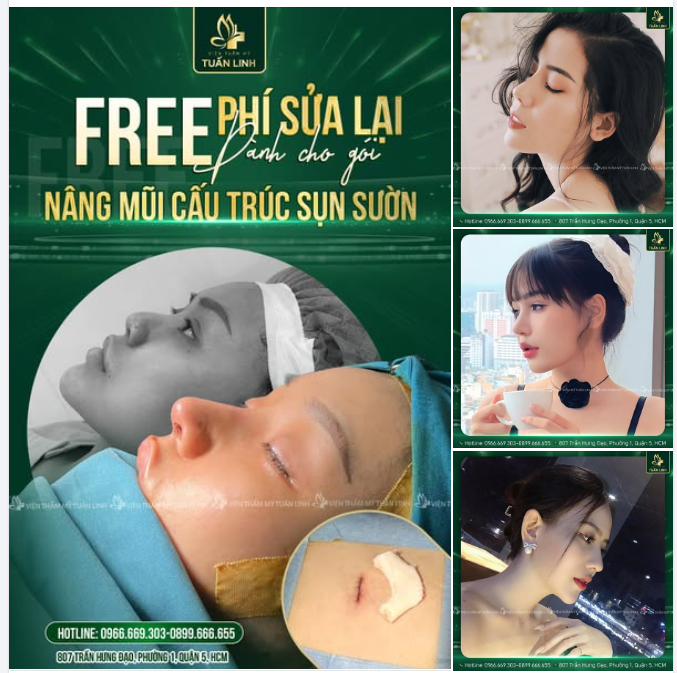 NÂNG MŨI CẤU TRÚC SỤN SƯỜN - ĐẸP HOÀN HẢO - FREE NGAY PHÍ SỬA LẠI!!
