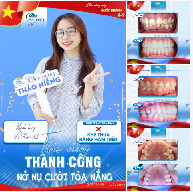 THÁO NIỀNG THÀNH CÔNG - NỞ NỤ CƯỜI TỎA NẮNG