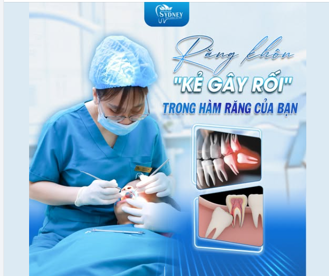 Bạn có biết hơn 70% người trưởng thành gặp rắc rối với răng khôn mọc lệch, mọc ngầm.