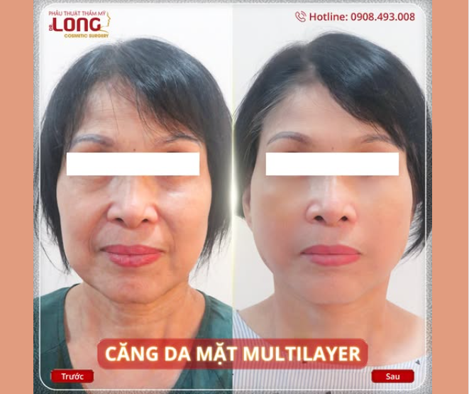 SIÊU SALE GẶP NGAY SIÊU PHẨM 8-8