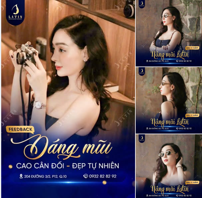 DÁNG MŨI TỰ NHIÊN – VẺ ĐẸP BỀN LÂU THEO NĂM THÁNG