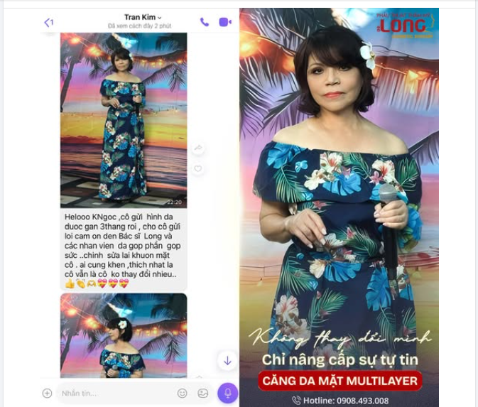 FEEDBACK KHÁCH IU SAU MÀN CĂNG DA MẶT