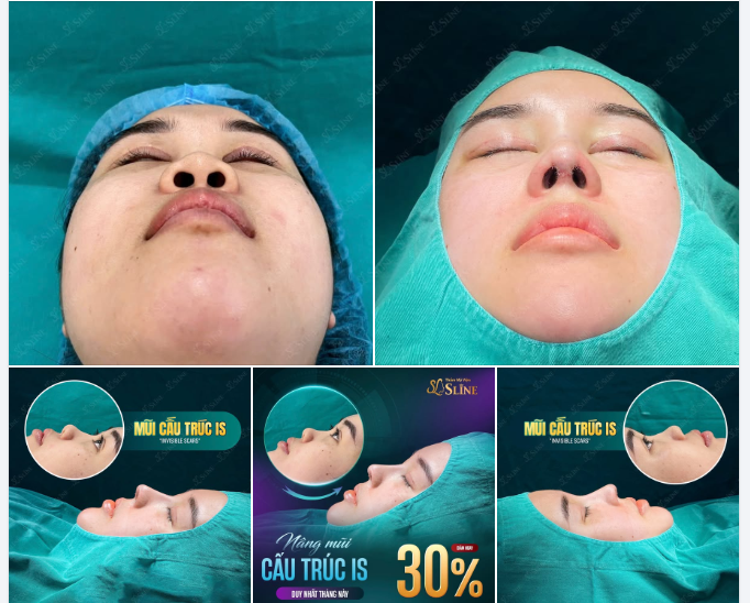 MỘT GÓC NHÌN – Hai cảm nhận