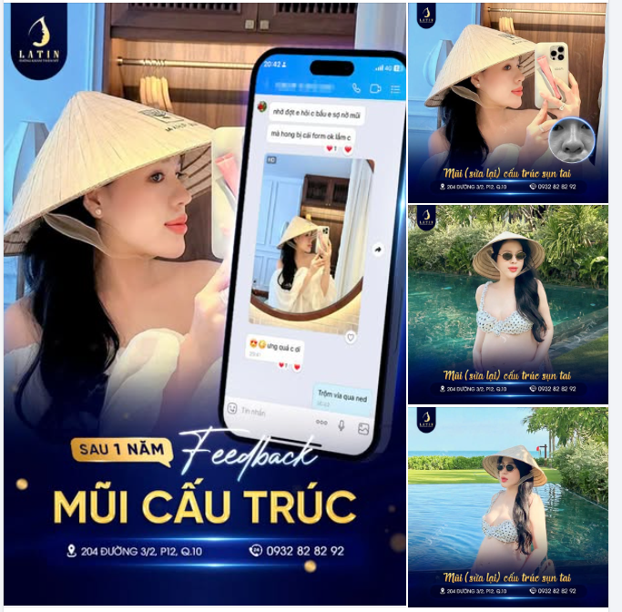 DÁNG MŨI SAU 1 NĂM VẪN XINH, DÙ ĐÃ LÊN CHỨC MẸ BỈM