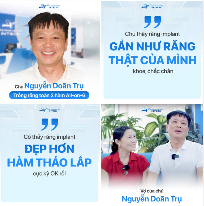 TRỒNG RĂNG IMPLANT TOÀN HÀM - ĐƯA VỊ NGON VÀ TIẾNG CƯỜI VỀ LẠI MÂM CƠM GIA ĐÌNH