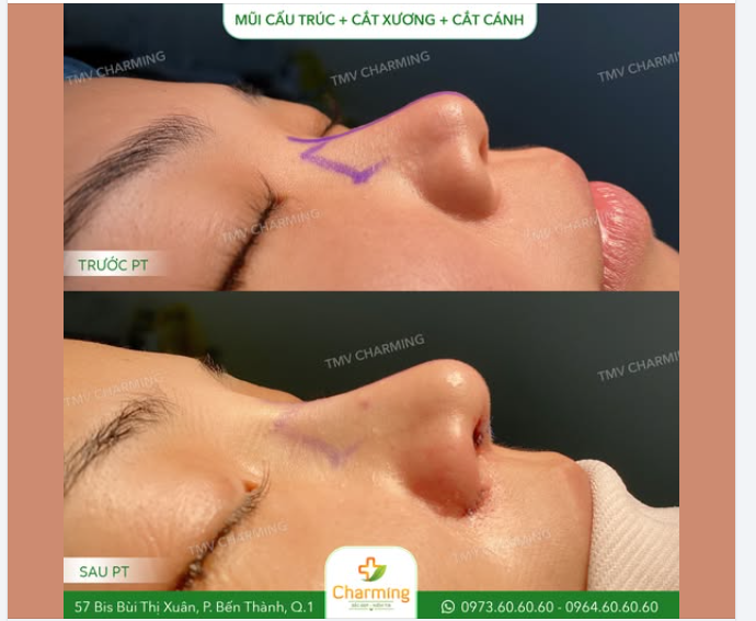 Góc nghiêng giờ đây hài hòa tuyệt đối, giúp nàng thêm phần tự tin.