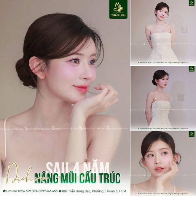 NÂNG MŨI CẤU TRÚC – CHÌA KHÓA SỞ HỮU DÁNG MŨI ĐẸP CHUẨN TỪNG GÓC NHÌN - BỀN CHẮC DÀI LÂU!!