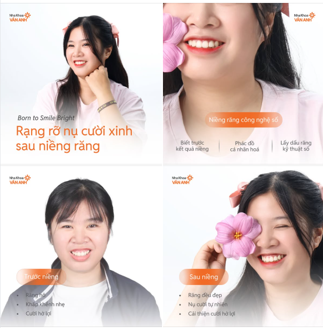 Niềng răng không chỉ làm đều răng – mà là hành trình học cách yêu lại chính mình