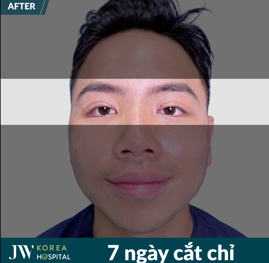 NAM SINH GEN Z VIỆT KIỀU MỸ HOÁ NAM THẦN ĐIỆN ẢNH TRONG 1 NỐT NHẠC CHỈ SAU CẮT MẮT 2 MÍ TẠI JW