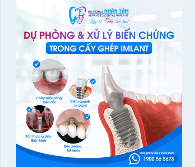 DỰ PHÒNG VÀ XỬ LÝ BIẾN CHỨNG TRONG CẤY GHÉP IMPLANT